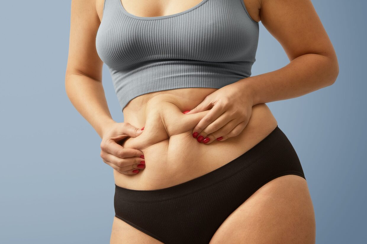 Liposuction in Dubai - Best Liposuction Surgery - Fat Removal